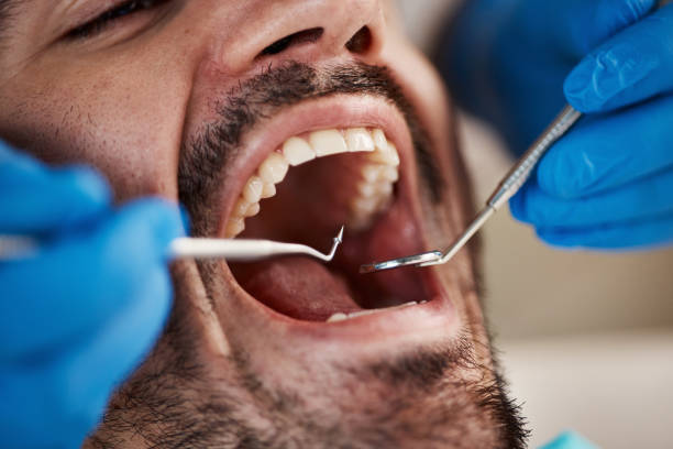 Best Emergency Cosmetic Dentistry in Denton, MD